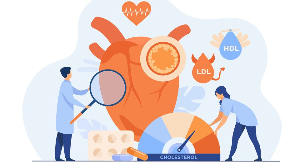 New Drug can Lower Cholesterol Without a Statin